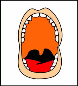 http://commons.wikimedia.org/wiki/File:Pharyngeal_flap_procedures3.gif